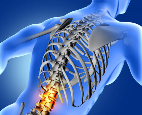 iskias diskusprolaps {{brizy_dc_image_alt imageSrc=